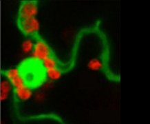 Chloroplasts